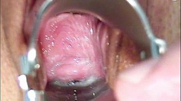 Camilla gyno chair pussy speculum exam at kinky gyno clinic