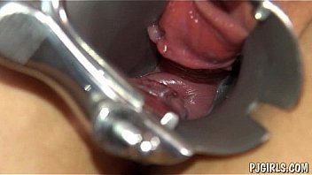 Violeta's orgasms with a speculum in her vagina